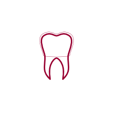 Veneers